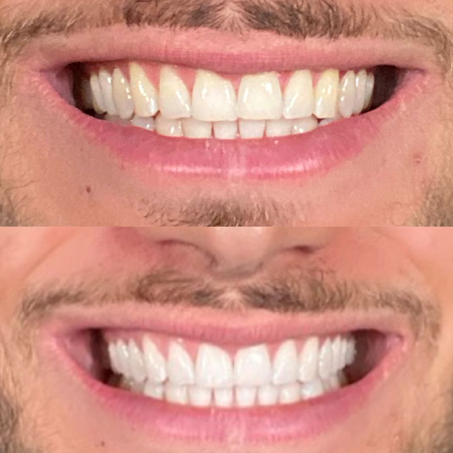 Gratis Nuancentabelle