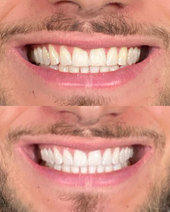 Gratis Nuancentabelle