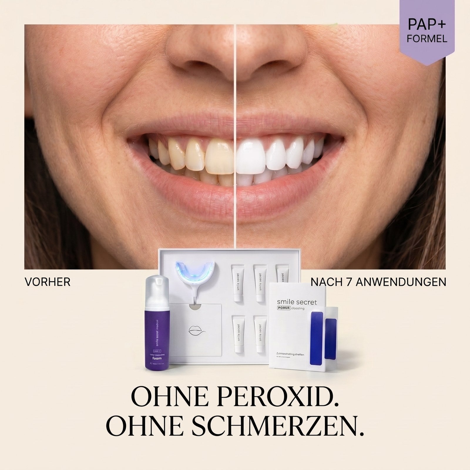 Vergleich